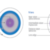 Biofinity Multifocal 3tk - Image 2